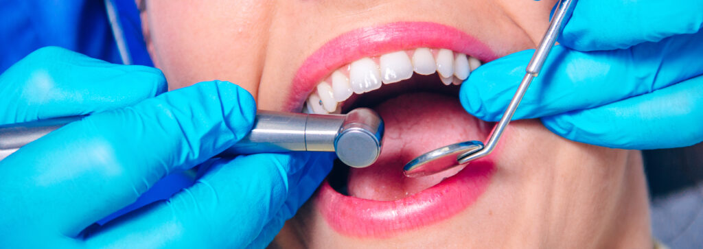 Dentist examining a patient's teeth in the dentist.