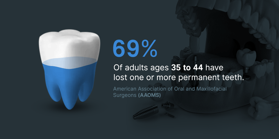 Dental Implant Guide What You Need To Know Hiossen® Implant 