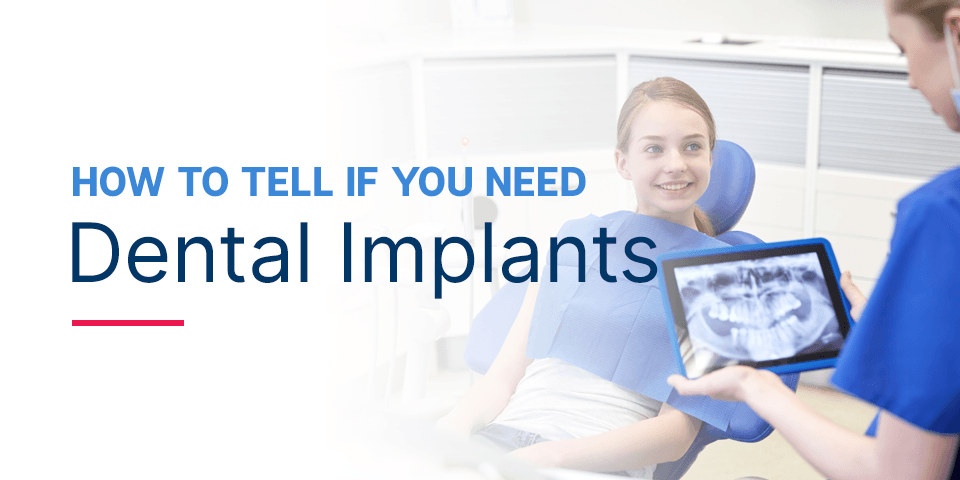 How to Tell If You Need Dental Implants - Hiossen® Implant