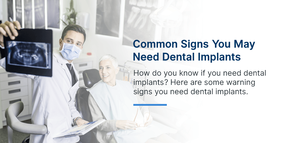 Common Signs You May Need Dental Implants