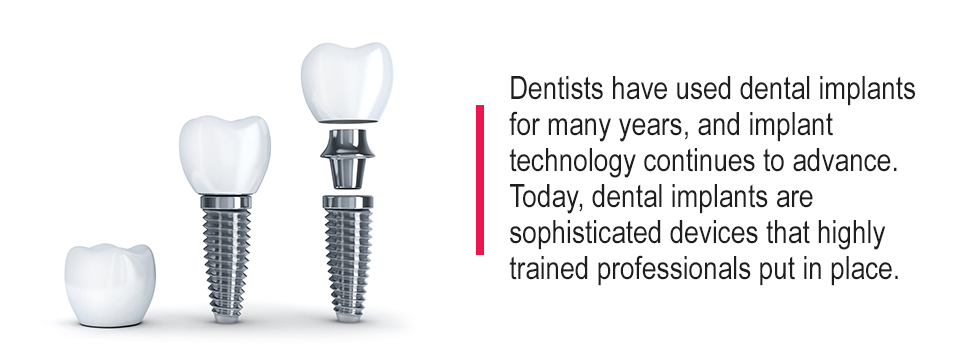 dental implants are safe