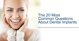 20 most common questions about dental implants