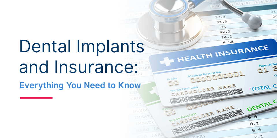 does-dental-insurance-cover-implants-all-you-need-to-know