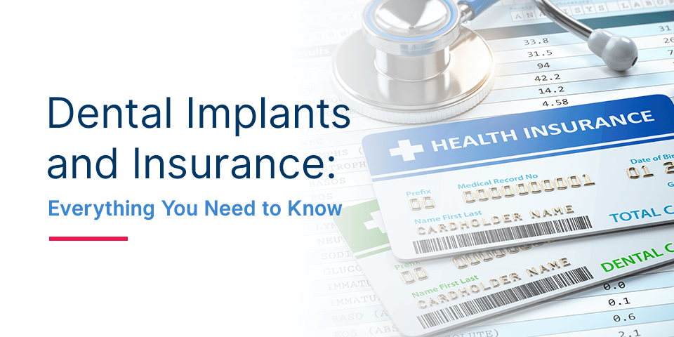 Does Dental Insurance Cover Implants All You Need To Know