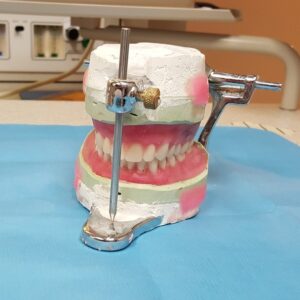 Switching from Dentures